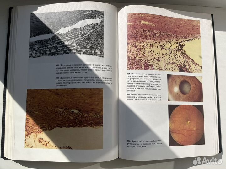 Атлас глазных болезней