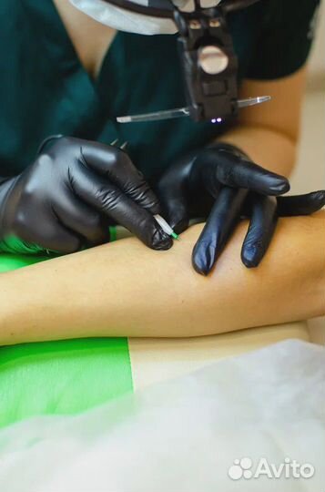 Электроэпилятор Микротерм Обучение Микро-терм