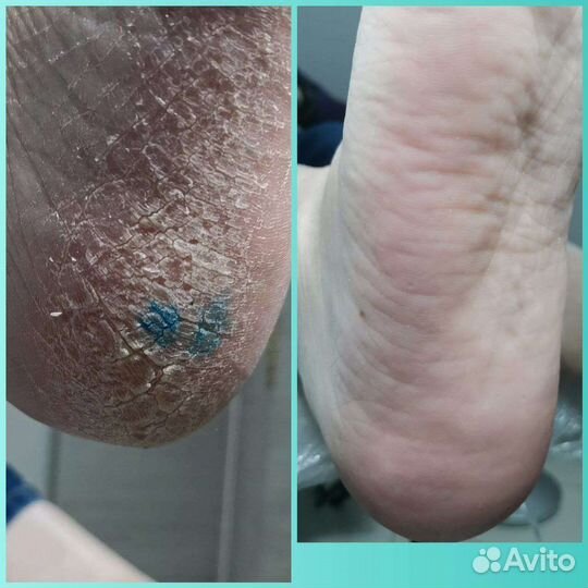 Подолог. Маникюр. Педикюр. Студия Нины Федоровой