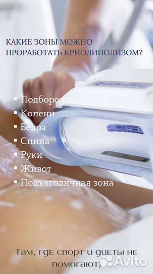 Криолиполиз