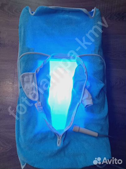 Аренда лампы от желтушки