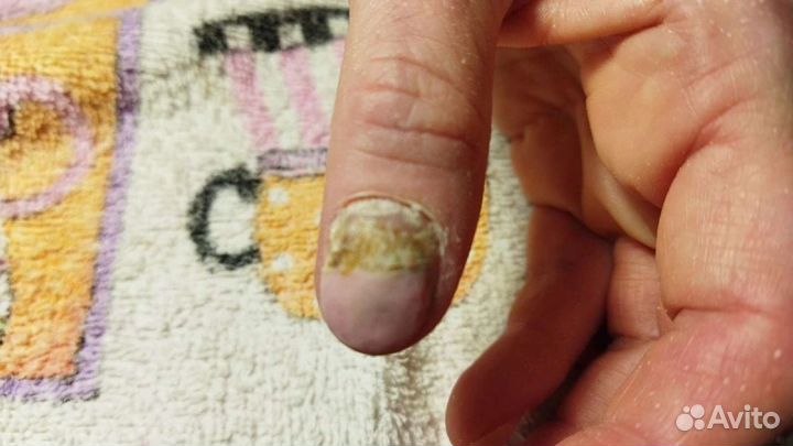 Педикюр подолог