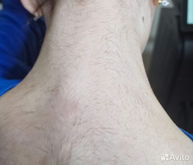 Мастер диодный эпиляции