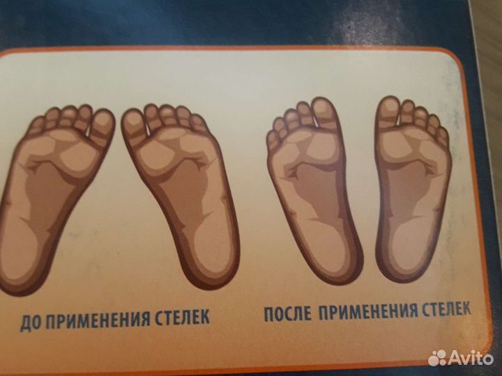 Стельки ортопедические детские