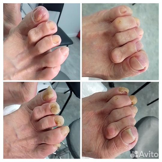 Маникюр /Педикюр/Подолог/выезд