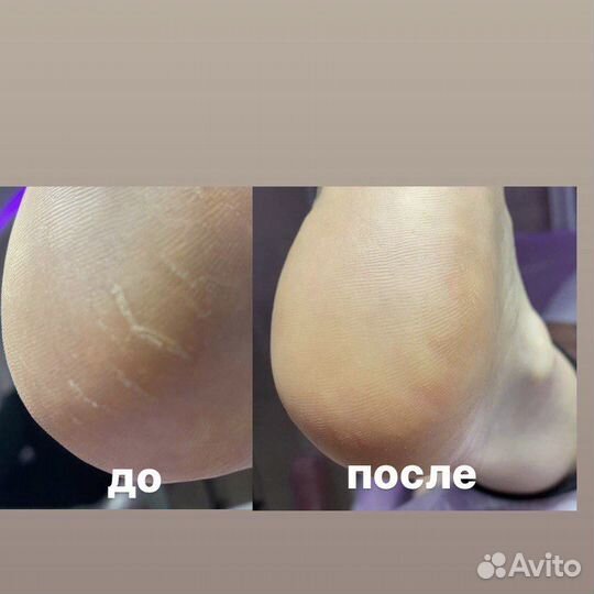 Педикюр с покрытием гель лак