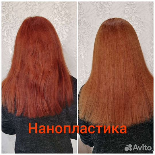 Лечение волос