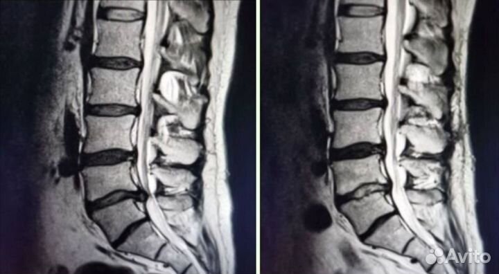 Костоправ Иваново (Виктор)