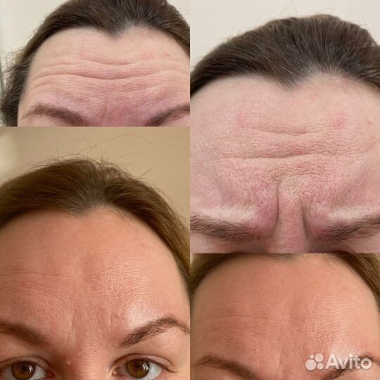 Косметология модели