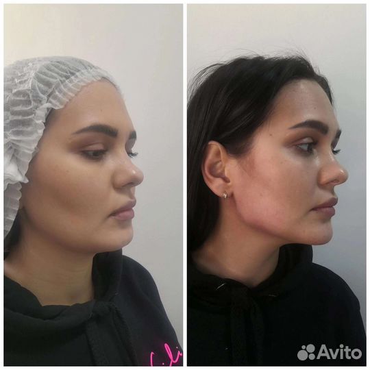 Косметолог.Лицо под ключ (Luxe Face)
