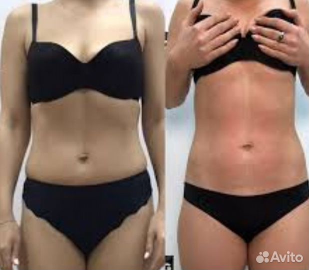 Массаж на аппарате старвак