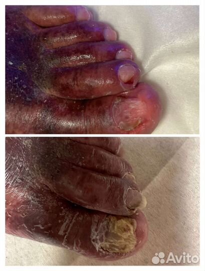 Услуги подолога