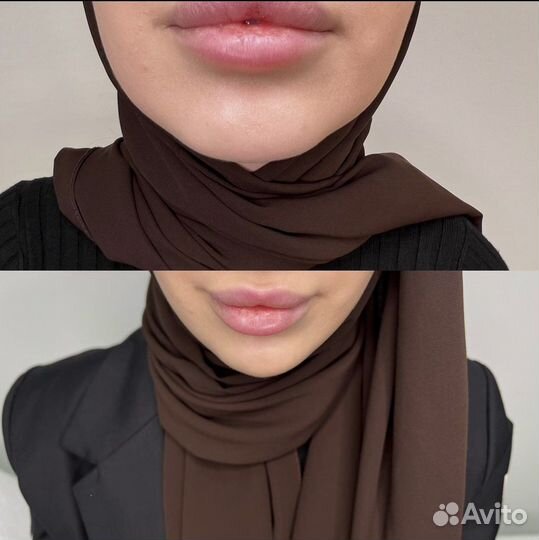 Биоревитализация