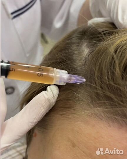 Уз чистка лица