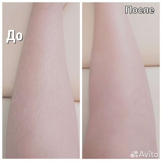 Шугаринг: руки выше локтя