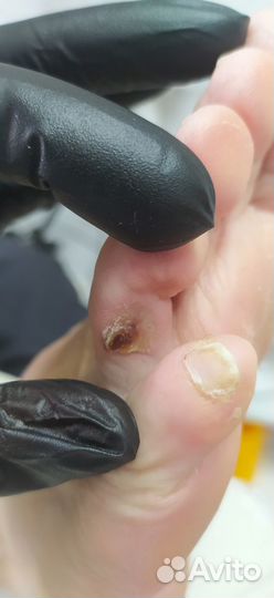 Подологический педикюр гпз/центр