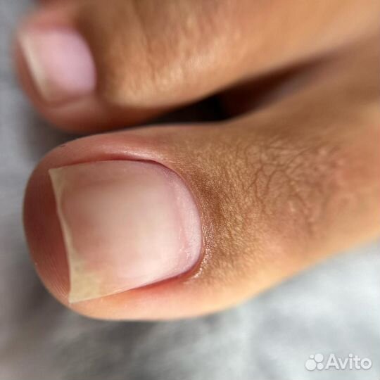 Педикюр повышающий качество жизни