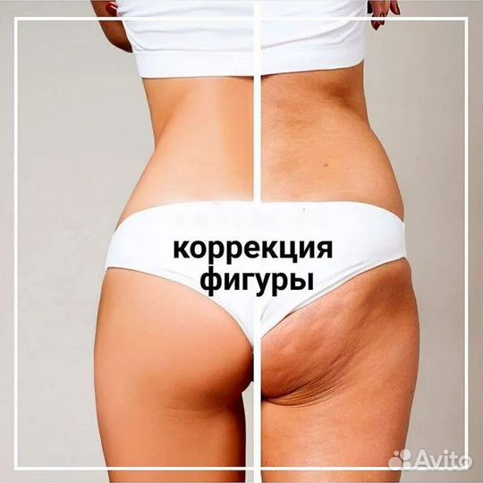 Коррекция фигуры