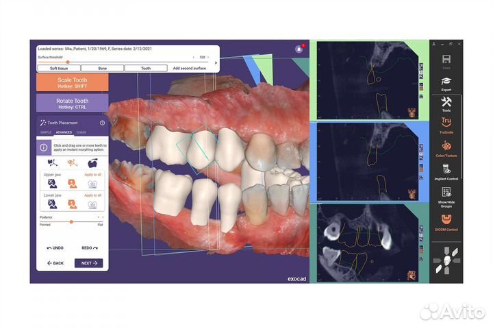 Exoplan Rijeka 3.1 v8587 (2023-07-06 )