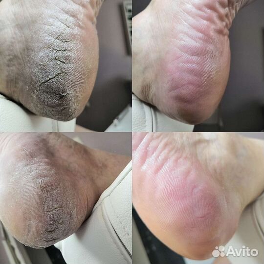 Маникюр, педикюр