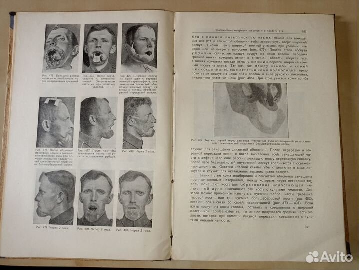 Оперативная хирургия. 3 тома. 1930