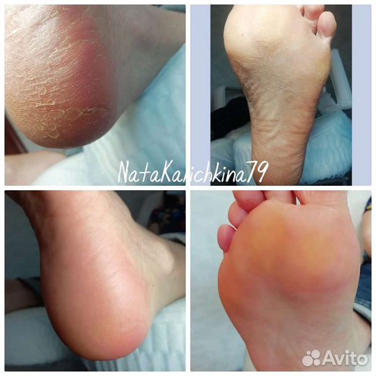 Аппаратный Маникюр, педикюр