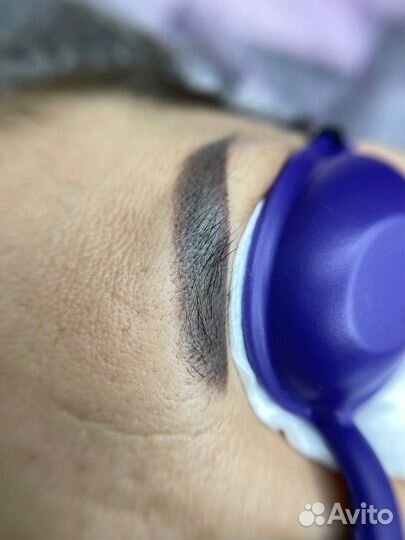 Удаление татуажа