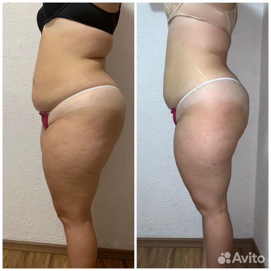 Коррекция фигуры