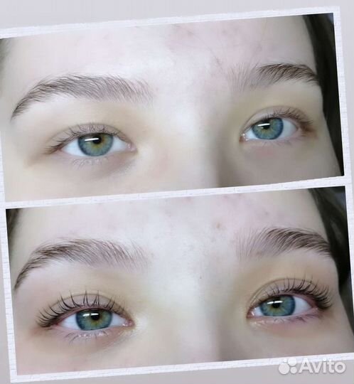 Наращивание ресниц, Шугаринг