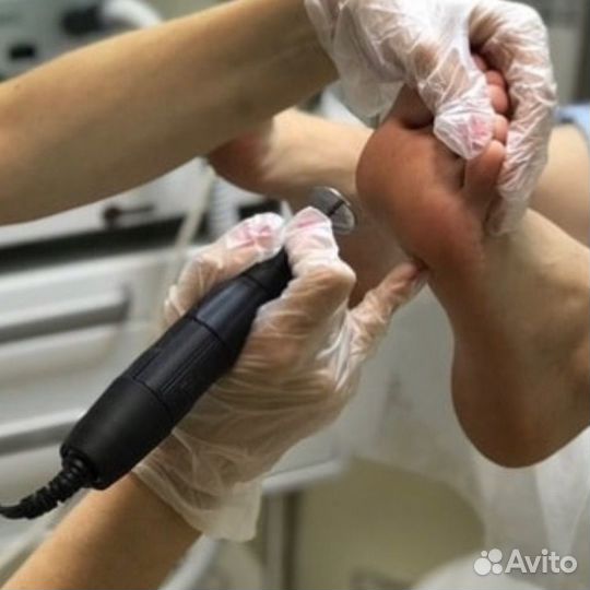 Инновационный Smart-педикюр