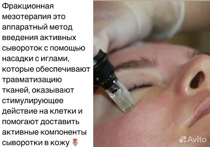 Косметолог, RF-лифтинг, УЗ чистка,мезотерапия