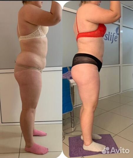 Кoмплeкс для похудения. Прощай живот