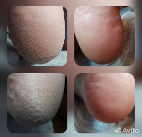 Маникюр, педикюр