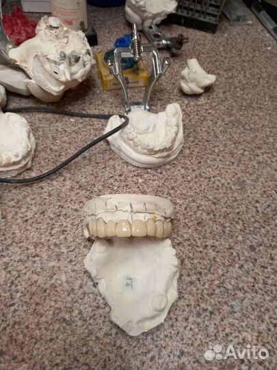 Работа зубной техник