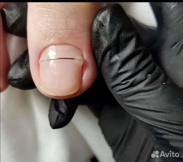 Эстетика.Мед.педикюр(Подология).Выезд на дом