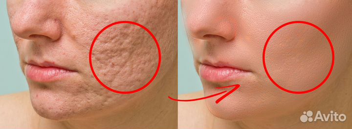 Услуги фотошопа / Обработка фотографий / Ретушь