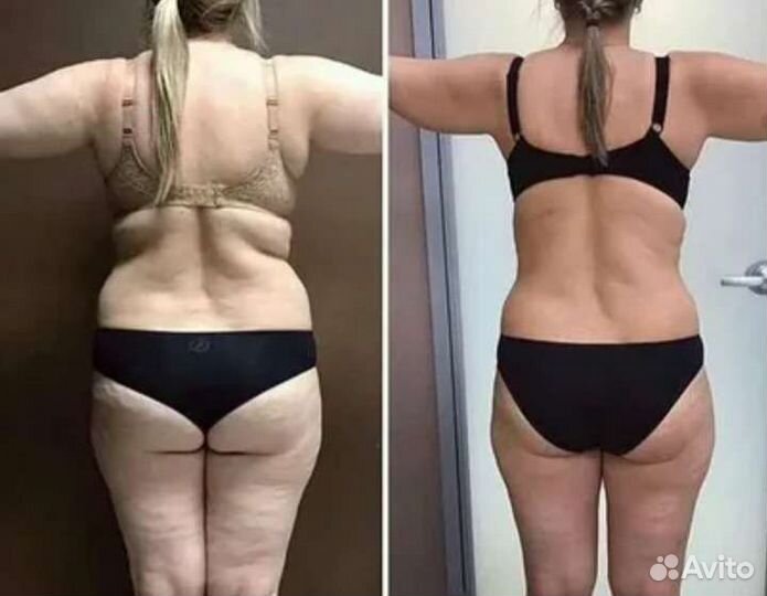 Массаж.Лпдж массаж.вибромассаж.Лпдж массаж лица