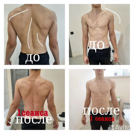 Массаж
