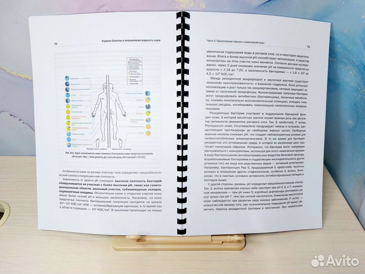 Угревая болезнь Е.Эрнандес