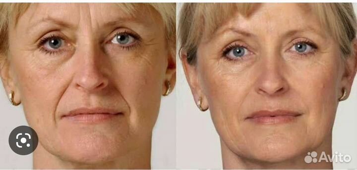 Антицеллюлитный массаж ручной,релакс,массаж лица