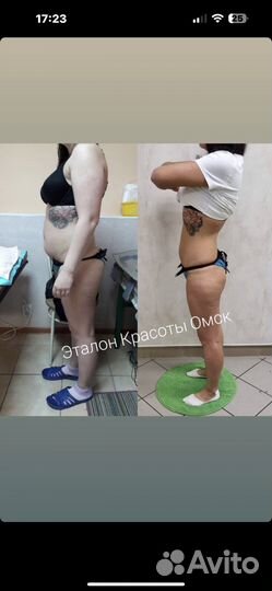 Коррекция фигуры/похудение/омск