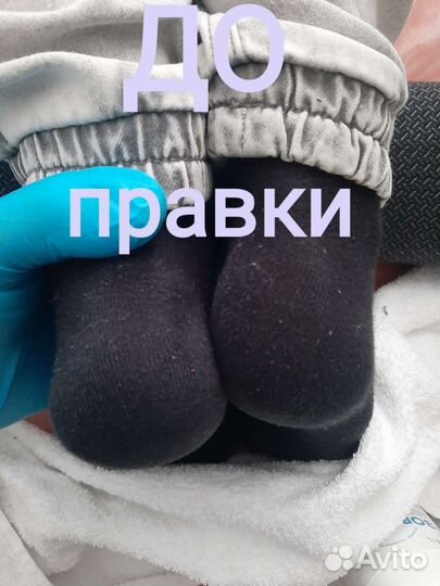 Костоправ Массажист Электрофорез