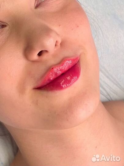 Врач косметолог