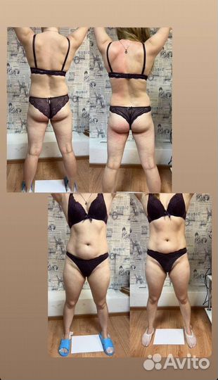 Коррекции фигуры (аппаратная и много др)