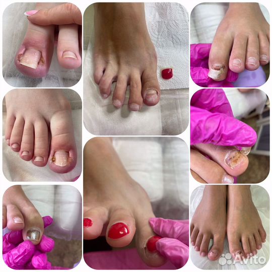Подолог/ педикюр