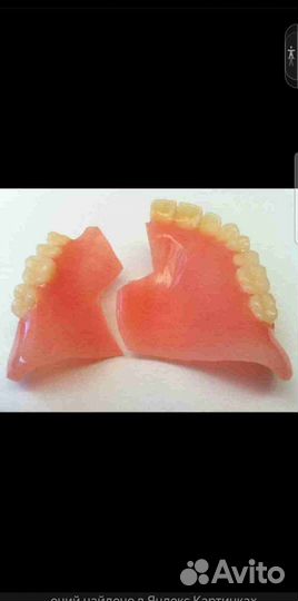 Ремонт и изготовление Съёмных зубных протезов