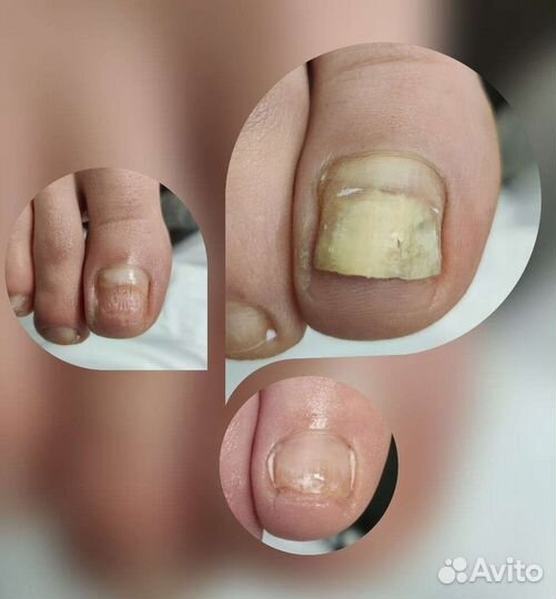 Подолог, Медицинский педикюр, Услуги подолога