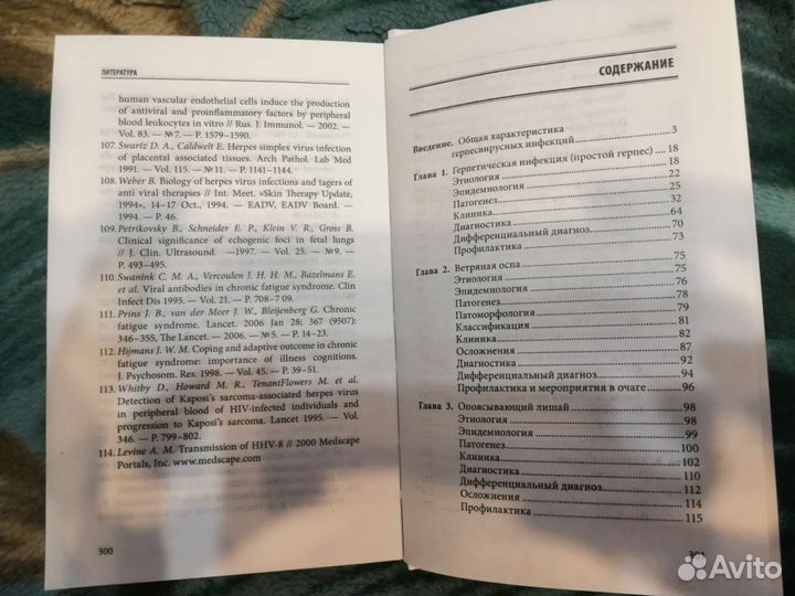 Герпесвирусная инфекция
