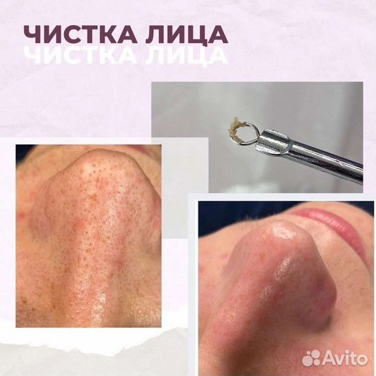 Услуги косметолога