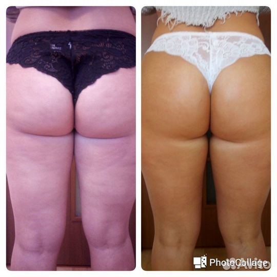 Абонемент на курс коррекции фигуры